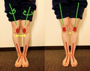 O脚コースについて